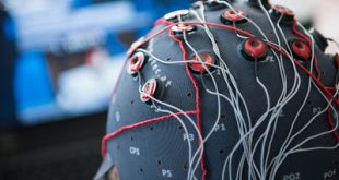 Οι πέντε μεγάλοι τύποι της προσωπικότητας έχουν το δικό τους εγκεφαλικό «προφίλ»