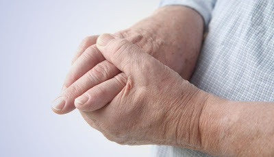 Τι να τρώτε και τι να μην τρώτε για το ουρικό οξύ. Φυσικά ροφήματα που μειώνουν το ουρικό οξύ