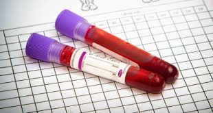 O Σύλλογος Ασθενών Ήπατος Ελλάδος «Προμηθέας» για τη διαπραγμάτευση των φαρμάκων της Ηπατίτιδας C