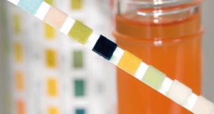 Αιματουρία, αίμα στα ούρα. Ποιες αιτίες την προκαλούν και πόσο σοβαρή είναι;