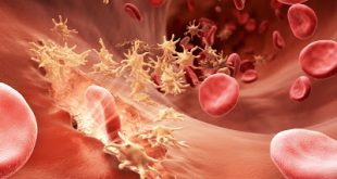 Εγκρίθηκε το Νέο Φάρμακο της CSL Behring για την Αιμορροφιλία Α