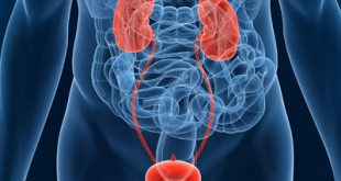 Νέα θεραπεία ασθενών με τοπικά προχωρημένο ή μεταστατικό ουροθηλιακό καρκίνωμα (mUC)