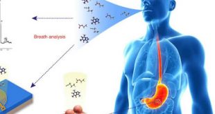Τεστ αναπνοής ανιχνεύει καρκίνο του οισοφάγου και του στομάχου