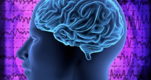 Νέα έγκριση φαρμάκου για ασθενείς με σύνδρομο οζώδους σκλήρυνσης που παρουσιάζουν επιληπτικές κρίσεις