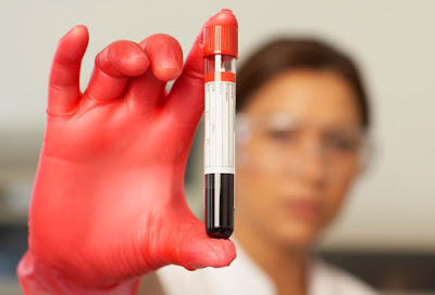 Νέα εξέταση αίματος ανιχνεύει καρκινικά κύτταρα πριν από τις συμβατικές μέθοδους