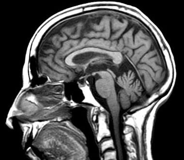 Ο εγκέφαλος μας δείχνει πιο post θα γίνει viral στο διαδίκτυο