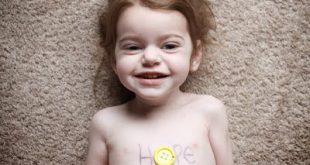 Ποιες είναι οι σπάνιες παθήσεις; Ένας στους δέκα Έλληνες πάσχουν από μία σπάνια ασθένεια (video)