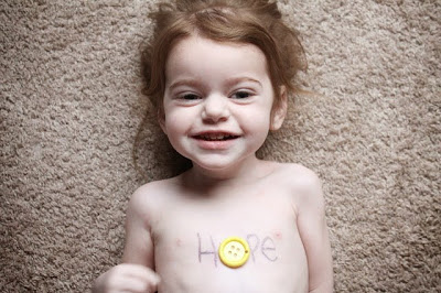 Ποιες είναι οι σπάνιες παθήσεις; Ένας στους δέκα Έλληνες πάσχουν από μία σπάνια ασθένεια (video)