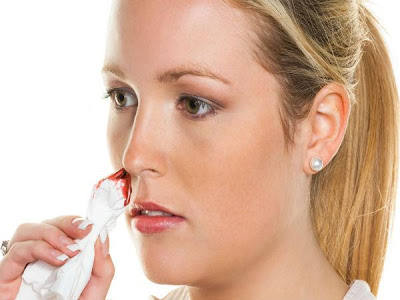 Τι πρέπει να κάνετε όταν ματώσει και τρέχει αίμα η μύτη; Πρώτες βοήθειες.