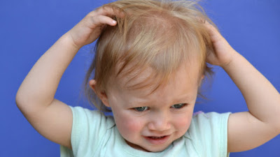 Φθείρες (ψείρες) και κόνιδα στο κεφάλι. Αντιμετώπιση και πρόληψη με φυσικά μέσα