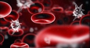 Χαμηλά αιμοπετάλια (θρομβοπενία) και αυξημένα αιμοπετάλια (θρομβοκυττάρωση). Που οφείλονται οι διαταραχές των αιμοπεταλίων.