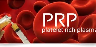 PRP: Μία αποτελεσματική μέθοδος στην αντιμετώπιση των ορθοπαιδικών παθήσεων
