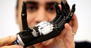 Tο πρώτο βιονικό χέρι με τεχνητή νοημοσύνη