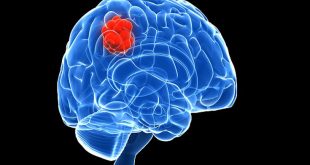 Αυτή είναι η άσκηση που τονώνει τη μνήμη