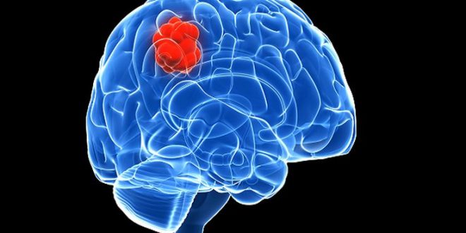 Αυτή είναι η άσκηση που τονώνει τη μνήμη