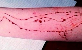 Μία 15χρονη, στην Κατερίνη, το πρώτο θύμα του διαδικτυακού παιχνιδιού «Μπλε Φάλαινα» στην Ελλάδα