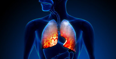 Η συσκευή εισπνοής για τις θεραπείες της Χρόνιας Αποφρακτικής Πνευμονοπάθειας (ΧΑΠ) της Novartis σχετίζεται με λιγότερα κρίσιμα λάθη κατά τον χειρισμό σε σχέση με άλλες συσκευές