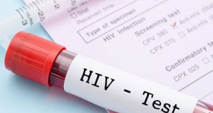 Νέο τεστ ανιχνεύει τον κρυμμένο ιό HIV