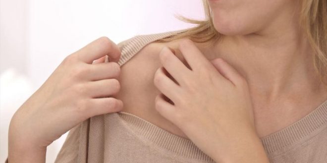 Ο απλός και φυσικός τρόπος να αντιμετωπίσετε τη φαγούρα