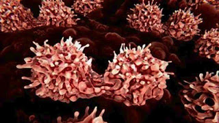 Οι γυναίκες που έκαναν θεραπεία για καρκίνο έχουν σχεδόν 40% μικρότερη πιθανότητα να μείνουν έγκυες