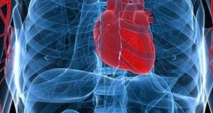 Πρωτοπορεί το "ΑΤΤΙΚΟΝ" νοσοκομείο στη διάγνωση των καρδιακών νοσημάτων με νέο σύγχρονο τεχνολογικό εξοπλισμό