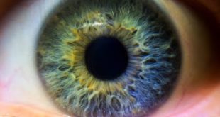 Το RTH258 (brolucizumab) της Novartis επιδεικνύει ισχυρά οφέλη για την όραση των ασθενών με νεοαγγειακή Ηλικιακη Εκφύλιση Ωχράς
