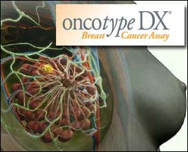 Η Ελληνική Ομοσπονδία Καρκίνου για την ανάκληση της Υπουργικής Απόφασης που αποζημίωνε την εξέταση ONCOTYPE DX, για ασθενείς με καρκίνο του μαστού