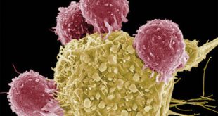 Καρκινικοί δείκτες Το μέλλον στη διάγνωση & στη πρόγνωση του καρκίνου;