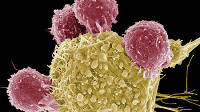 Καρκινικοί δείκτες Το μέλλον στη διάγνωση & στη πρόγνωση του καρκίνου;