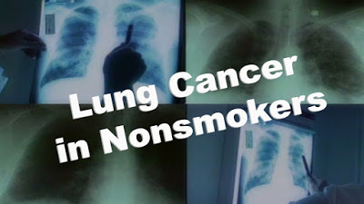 Και οι μη καπνιστές κινδυνεύουν από καρκίνο του πνεύμονα