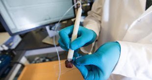 Χειρουργικό «πενάκι» διακρίνει με ακρίβεια τον καρκίνο από τον υγιή ιστό