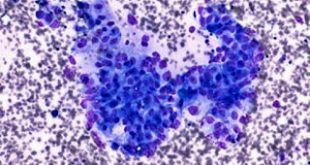 Ρώσοι θα επενδύσουν στην Πάφο για δημιουργία Μεσογειακού Κέντρου αντιμετώπισης του καρκίνου