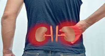 Mπορεί ο πόνος στην μέση να είναι από τα νεφρά; Νεφρολιθίαση και οξεία νεφρική ανεπάρκεια