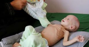 Λιμοκτονούν χιλιάδες παιδιά στην Υεμένη