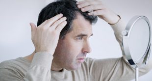 Τρία πράγματα που προκαλούν τριχόπτωση