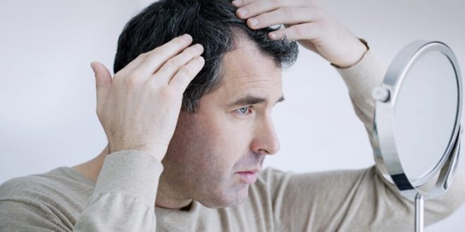 Τρία πράγματα που προκαλούν τριχόπτωση