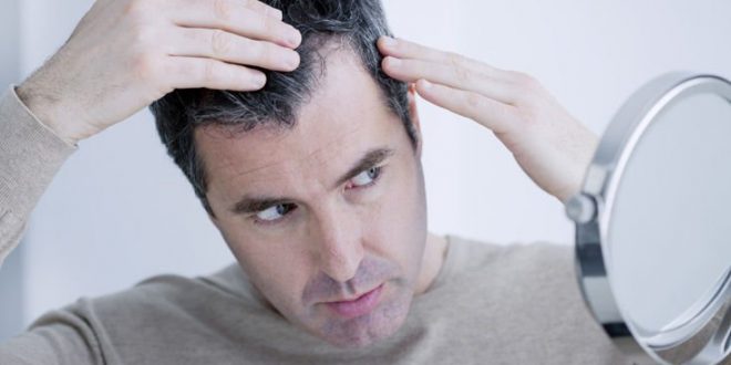 Υπάρχει εποχιακή τριχόπτωση και πλήττει τους άντρες;