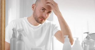 Επιστήμονες πιστεύουν πως βρήκαν επιτέλους τη θεραπεία της φαλάκρας