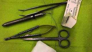 Νέα μέθοδος εντοπίζει τις γυναίκες που κινδυνεύουν περισσότερο ο καρκίνος του μαστού να κάνει μεταστάσεις από τους λεμφαδένες