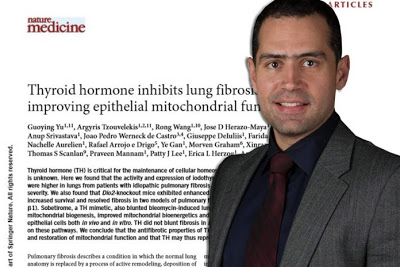Σπουδαία ανακάλυψη για τη θεραπεία της πνευμονικής ίνωσης με επικεφαλής τον Έλληνα Πνευμονολόγο, Αρ. Τζουβελέκη