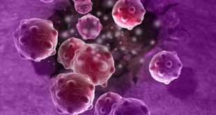 Το nivolumab αποτελεί καινοτόμο θεραπευτική επιλογή στον τομέα της ανοσο-ογκολογίας