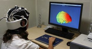 Δοκιμάστηκε ο πρώτος «βηματοδότης» εγκεφάλου σε ασθενείς με Αλτσχάιμερ