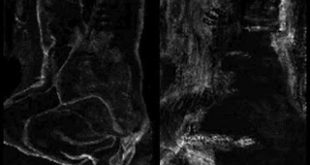 Ερευνητές ανακάλυψαν το κρυφό έργο άλλου ζωγράφου κάτω από πίνακα του Πικάσο