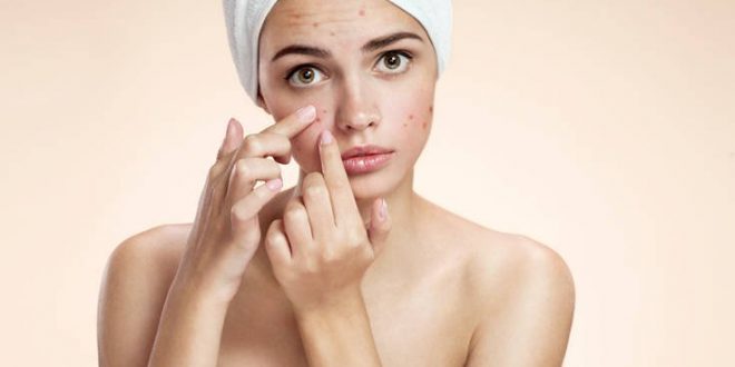 Η ακμή προκαλεί κατάθλιψη