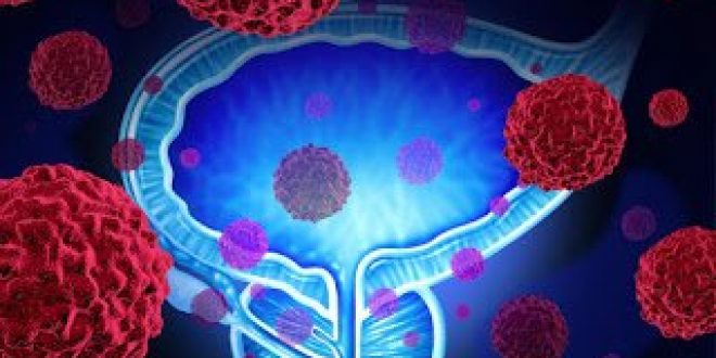 Τεχνητή νοημοσύνη για τη διάγνωση του καρκίνου του προστάτη