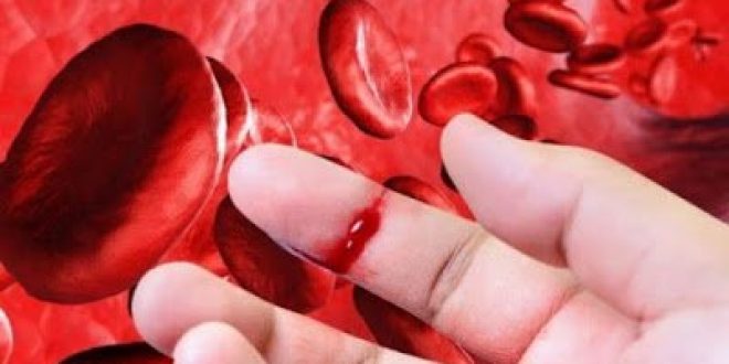 Αιμορροφιλία, τι είναι, τι προκαλεί και πώς αντιμετωπίζεται; Πρώτες βοήθειες αιμορραγικού επεισοδίου