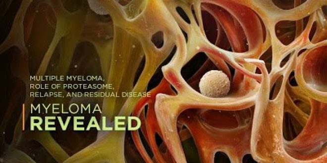 Εγκριση για τη δενοσουμάμπη, για την πρόληψη των σκελετικών συμβαμάτων, οστικών μεταστάσεων και σε ασθενείς με πολλαπλό μυέλωμα