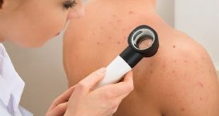 Κάντε το τεστ για να δείτε αν κινδυνεύετε περισσότερο από τον καρκίνο του δέρματος;