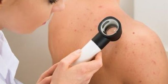Κάντε το τεστ για να δείτε αν κινδυνεύετε περισσότερο από τον καρκίνο του δέρματος;