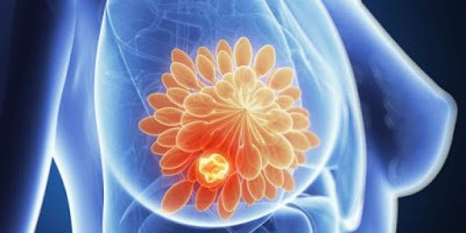 Καρκινικός δείκτης για τον καρκίνο του μαστού, το καρκινικό αντιγόνο 15-3 (CA 15-3)